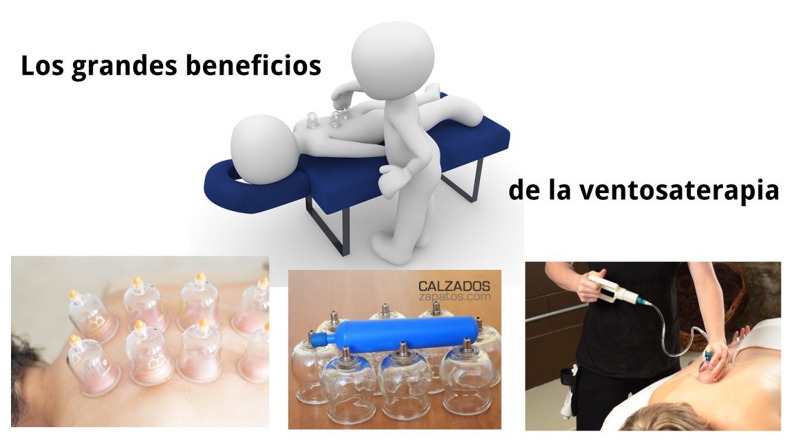 Los grandes beneficios de la ventosaterapia 